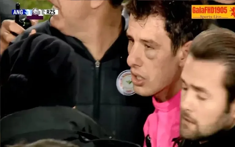 Árbitro anuncia aposentadoria após ser agredido em jogo na Turquia