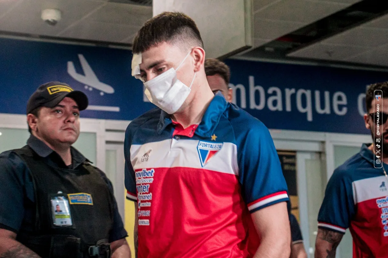 Alex Escobar faz alerta após ataque ao ônibus do Fortaleza: “Brasil aguarda a tragédia”